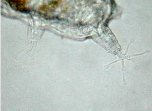 [ 'normal' 4th pair of legs (Batillipes) ]